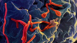 How Viruses Hide Inside Your Eyeballs, Even When You're No Longer Sick